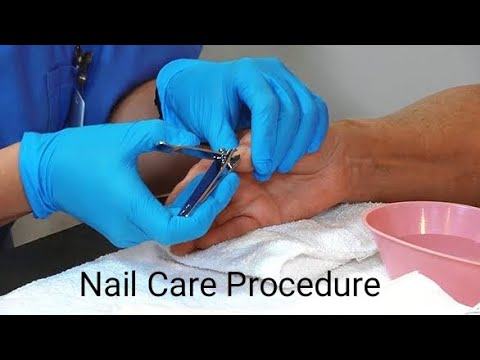 Nail cutting procedure for patient l Medical and Nursing l Rashmi Rajora -  YouTube