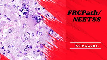 NEET SS / FRCPath - MCQ Discussion