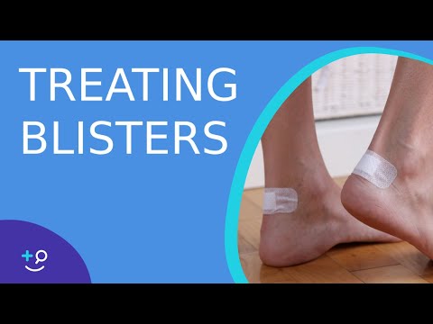 Video: Hvordan behandle blemmer på føttene?