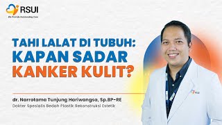 Tahi Lalat di Tubuh : Kapan Curiga Kanker Kulit?