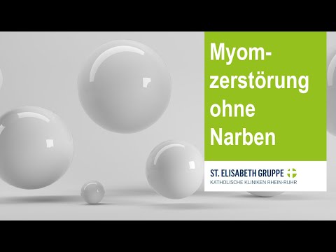 Video: Myome - Behandlung Von Myomen Mit Volksheilmitteln Und -methoden