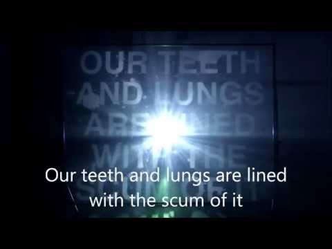 Hozier - Sedated