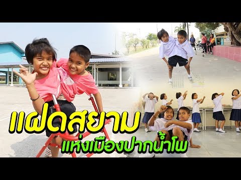 แฝดสยาม 2 ชีวิตมหัศจรรย์ l ไทยทึ่ง WOW! THAILAND