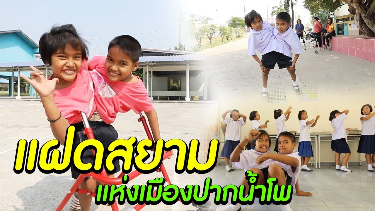 แฝดสยาม 2 ชีวิตมหัศจรรย์ l ไทยทึ่ง WOW! THAILAND
