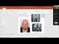 Pitutary Apoplexy Professor Tomislav Sajkp 