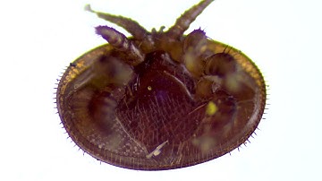 Varroa Destructor Mite In My 4k Video Microscope