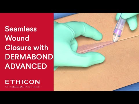 How To Apply DERMABOND ADVANCED Topical Skin Adhesive Effectively