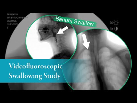 Barium Swallow Vs Endoscopy