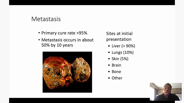 Eye Believe Survivorship Seminar  Uveal Melanoma G...