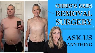 Laura & Chris Livestream before Chris's Skin Removal Surgery: Ask Us Anything