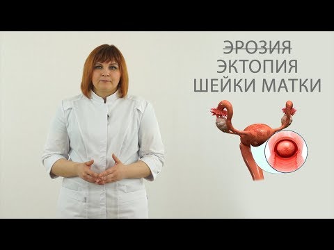 эрозия  ( эктопия )  шейки матки