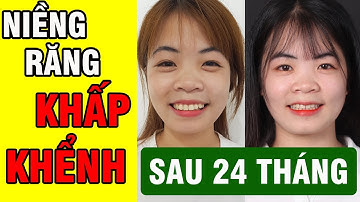 Tháo mắc cài - tạm biệt răng khấp khểnh, lệch lạc.