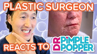 Plastic Surgeon Reacts to DR. PIMPLE POPPER: Severe Neurofibromatosis!