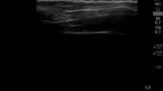 Download Lagu Ariel Barneto MP3