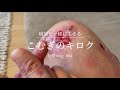 【表皮水疱症】病院から大量のガーゼを仕入れてきた 日常vlog #04
