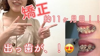 矯正女子 Youtube