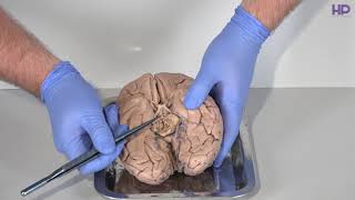 Нейробиология | Общее строение головного мозга. Часть 2