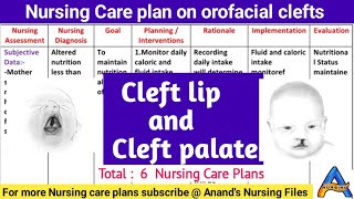 Nursing Care Plan on Cleft lip and cleft palate//Nursing care plan for cleft lip and cleft palate