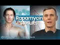 Comparing bryan johnsons rapamycin data interesting results  31  rfiles 5