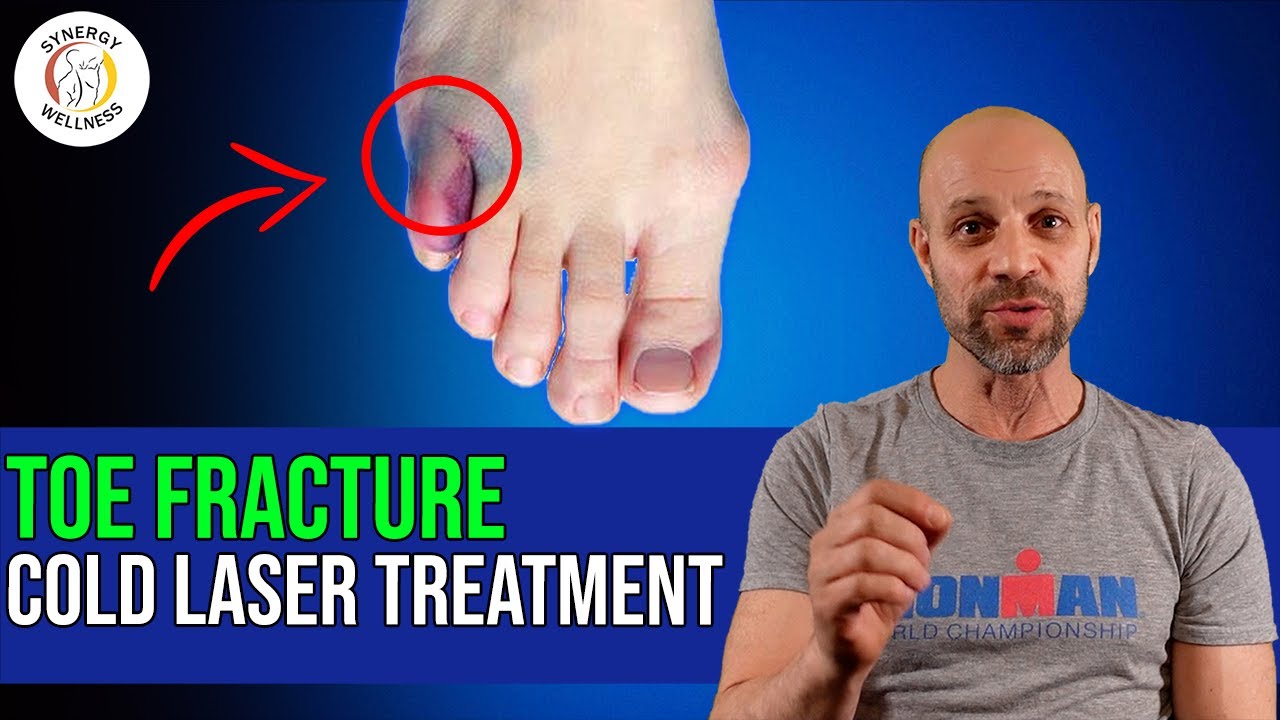 Toe Fracture Treatment Cold Laser