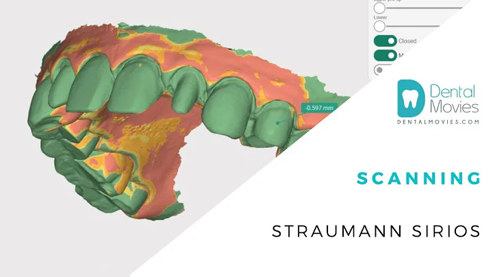 Scanning - Straumann SIRIOS