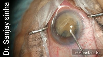 Dr. Sanjay sinha, Patna