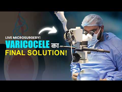 Low Sperm Count + Varicocele | Microsurgery vs Embolization | Microsurgery से पक्का इलाज