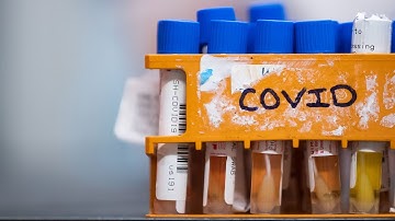 Lab error resulted in false COVID-19 results, says Sask. health authority