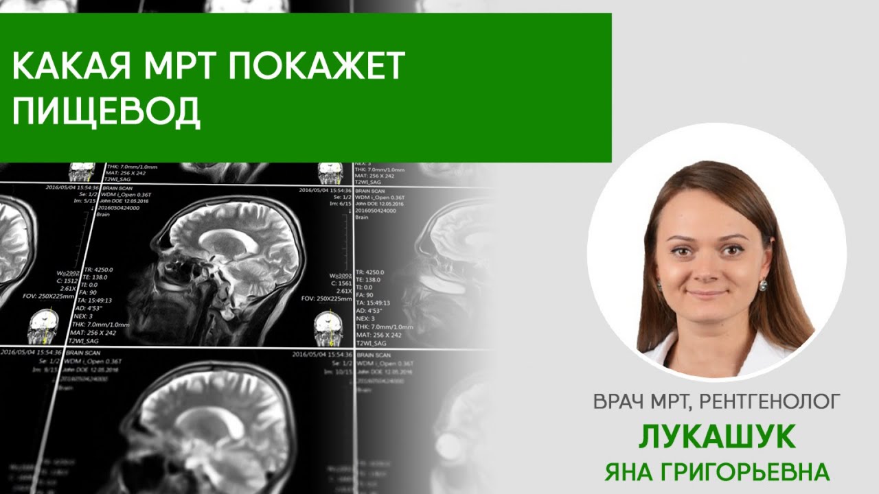 Какая МРТ покажет носоглотку