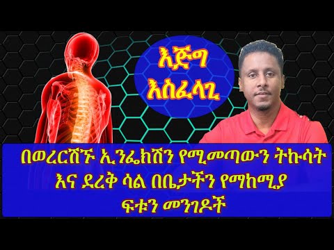 ቪዲዮ: ለ X እና Y ደንቡ ምንድን ነው?