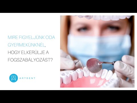 Videó: Hogyan Kell Fogyasztani Az Olívaolajat