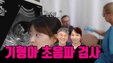 정밀 초음파 검사. 태아 기형 유무를 확인하는 기본검사. 『임신과 출산』 5번째 이야기. ??‍⚕산부인과 의사 3인이 풀어가는 유익한 의학채널