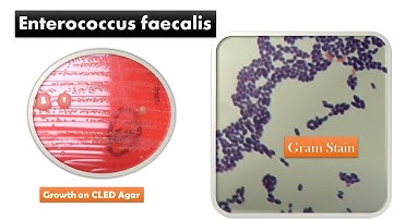 Enterococcus faecalis Colony Morphology and Gram Staining