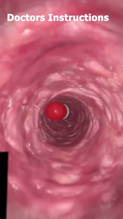 How To CAPSULE 💊 Metabolize in Stomach💊🩸 #animation #1million #3d