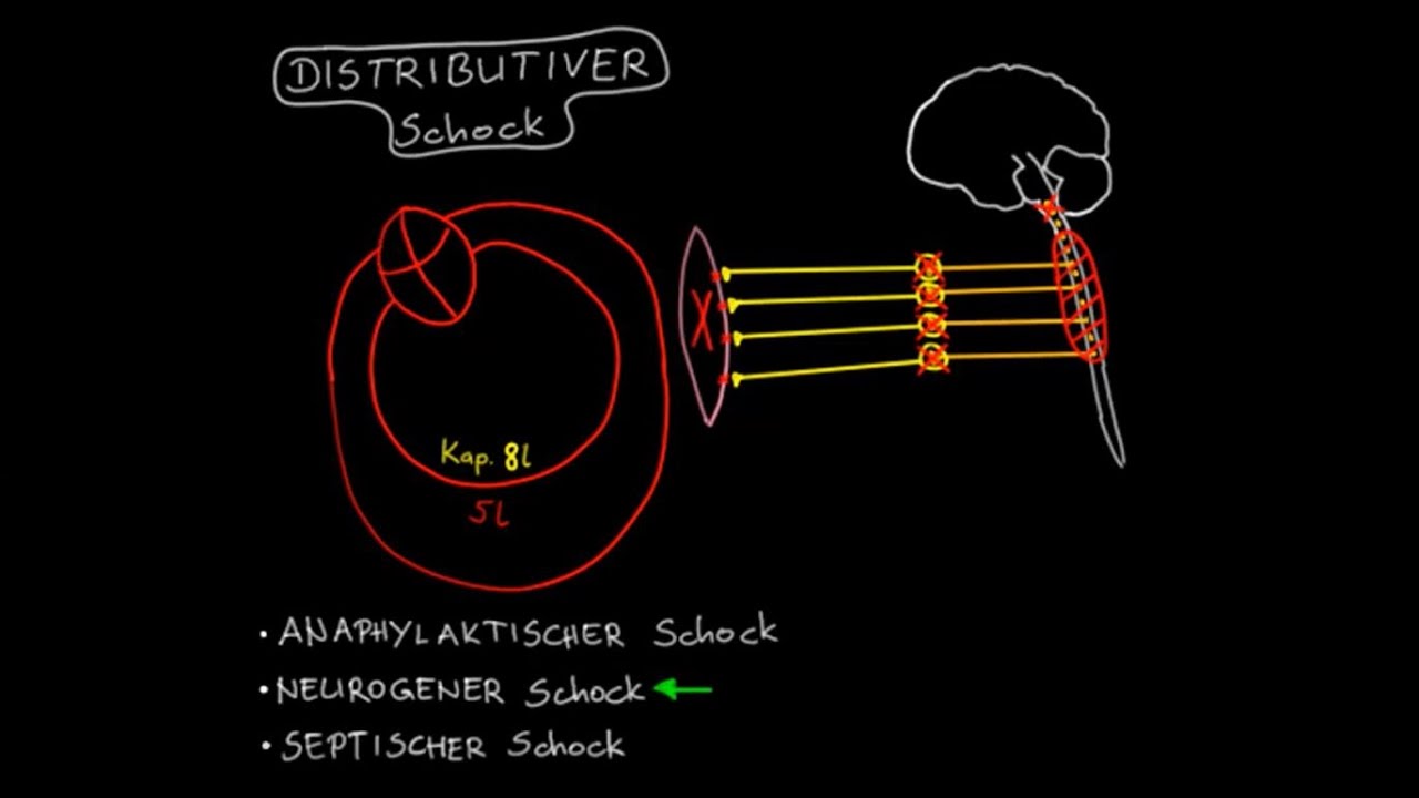 Kreislaufschock (4/7) – Distributiver Schock (Vorschau) — Transcript