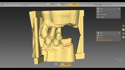 How to create an Elos Accurate® Implant Model in inLab Model SW