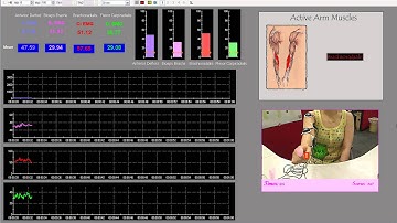 Development of Augmented Reality Rehabilitation Games Integrated with Biofeedback for Upper Limb 1