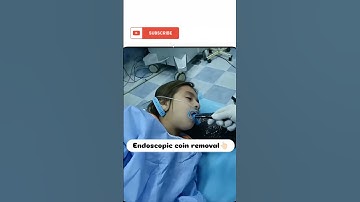 ENDOSCOPIC COIN REMOVAL