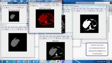 Liver Segmentation on CT and MR Using Laplacian Mesh Optimization