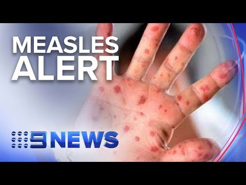 Video: Onko Uusi Ebola-kanta Tappaa Lintuja Massiivisesti Australiassa? - Vaihtoehtoinen Näkymä