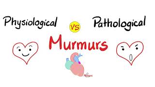 Physiological Murmurs vs Pathological Murmurs | Comparisons