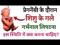 प्रेगनेंसी के दौरान शिशु के गले में गर्भनाल लिपटना | Umbilical Cord wrapped around baby neck |