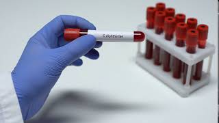 Diphtheria Diagnosis- Data Management