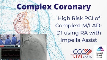 High Risk PCI of Complex﻿LM/LAD-D1 using RA with Impella Assist