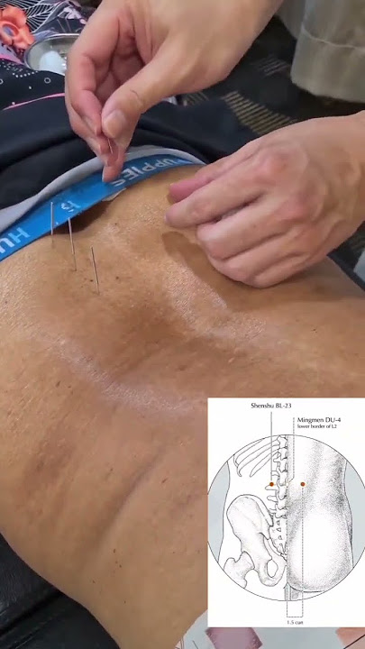 SCIATICA INFLAMMATION CAN CAUSE MANY PAINS