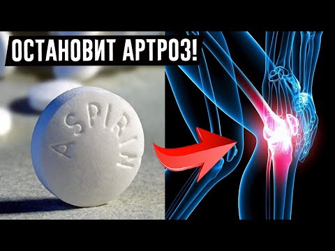 Узнайте, как можно избавится от артрита!Вылечите суставы в домашних условиях 2 копеечными средствами