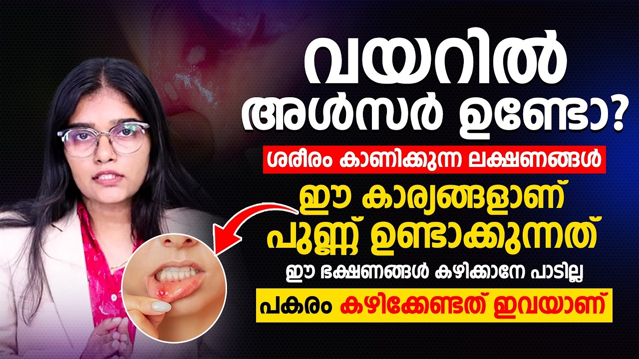വയറിൽ അൾസർ ഉണ്ടോ | ഈ ഭക്ഷണങ്ങൾ കഴിക്കാനേ പാടില്ല പകരം കഴിക്കേണ്ടത് ഇവയാണ് | mouth ulcer
