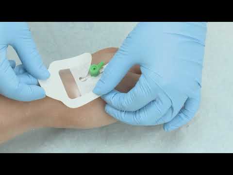 Mepore® IV - Anwendungsvideo - Mölnlycke Health Care