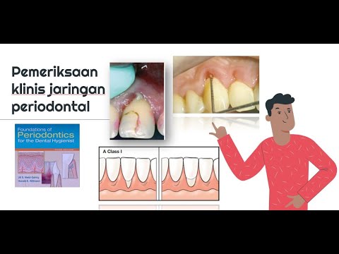 Video: Apakah yang dilakukan oleh pakar periodontik?
