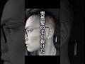 誰にも言えなかった脱毛症、支えられ立ち直ってみせた。#ウィッグ #脱毛症 #alopecia #wig #가발